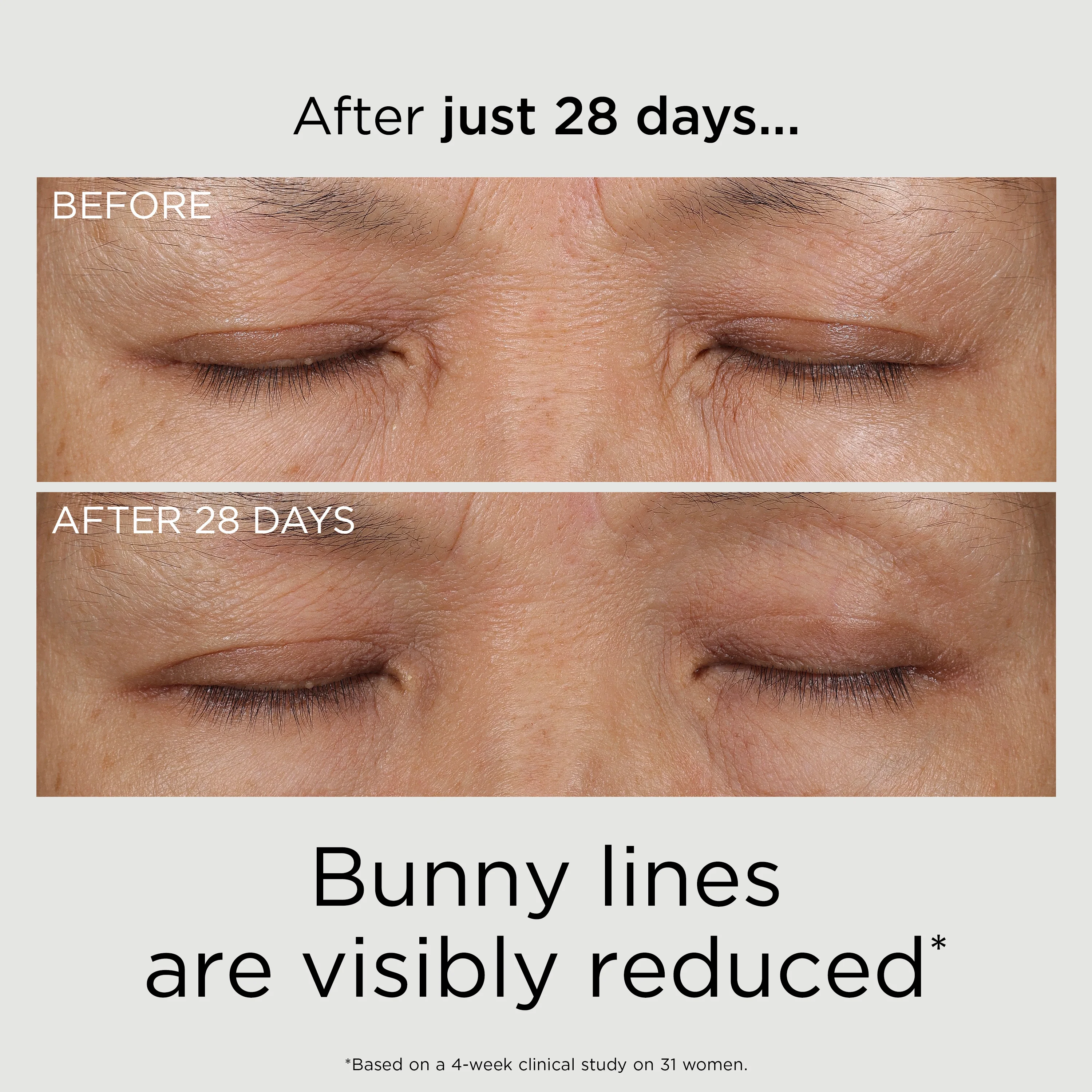 PREVAGE® 3-in-1 Reset Serum - Image 10