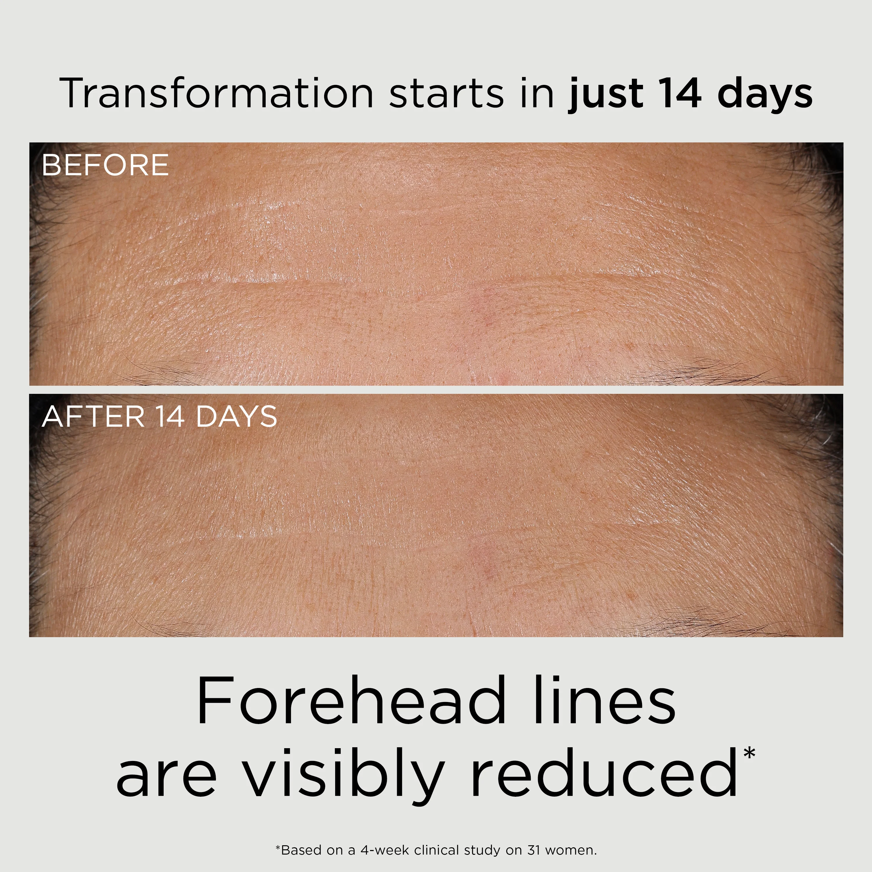 PREVAGE® 3-in-1 Reset Serum - Image 9