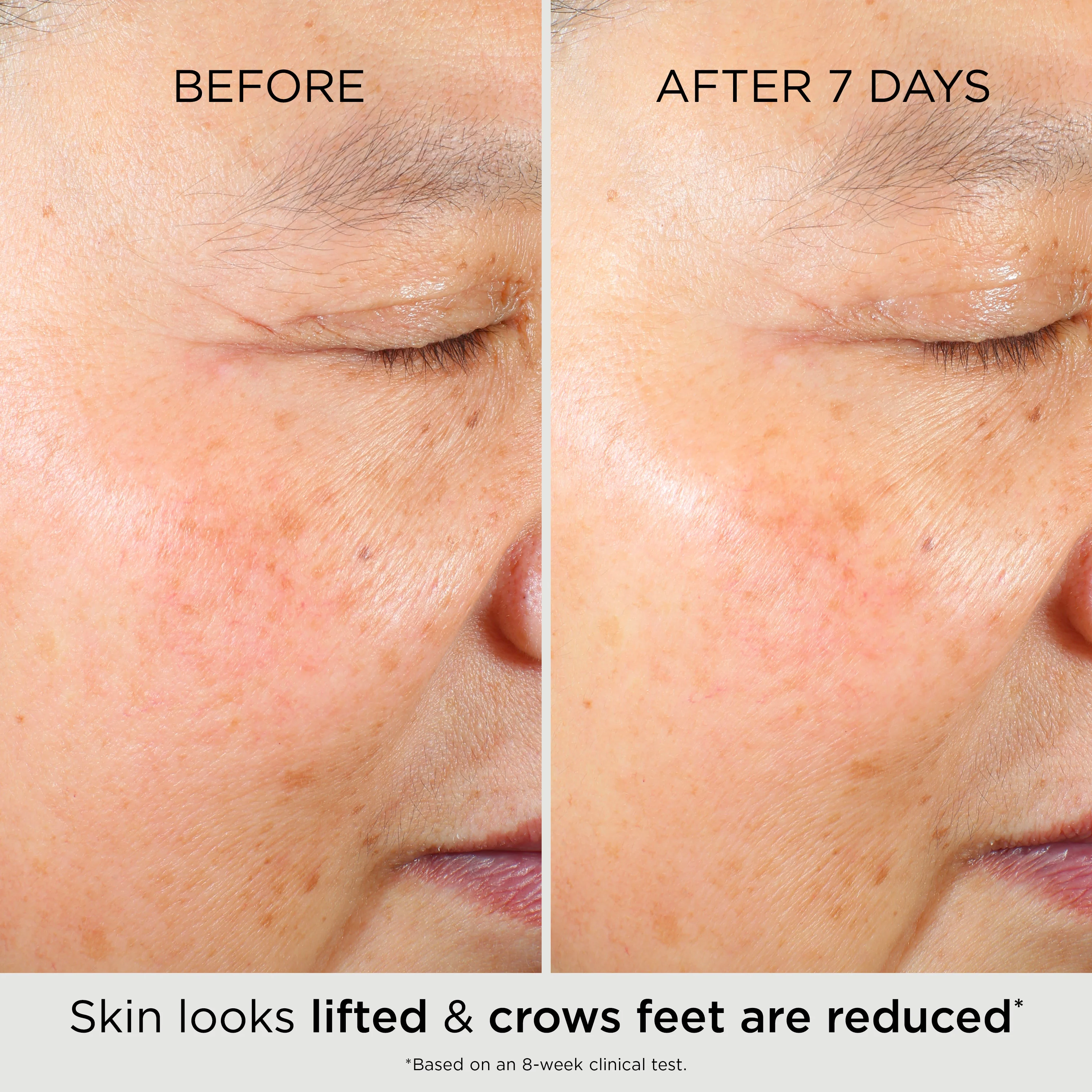 PREVAGE® Multi-Restorative Soft Cream - Image 4