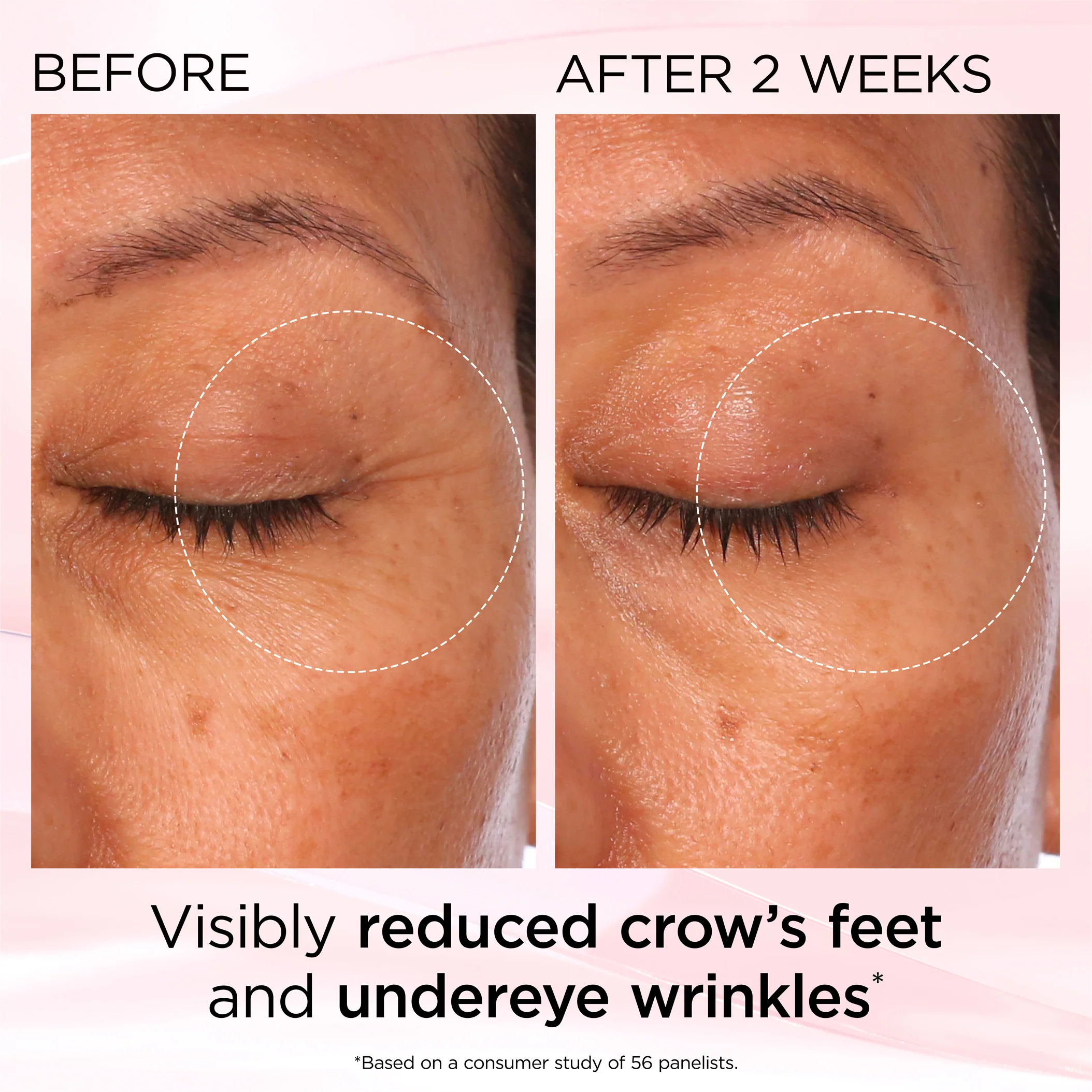 Retinol + HPR Ceramide Rapid Skin Renewing Eye Cream - Image 12