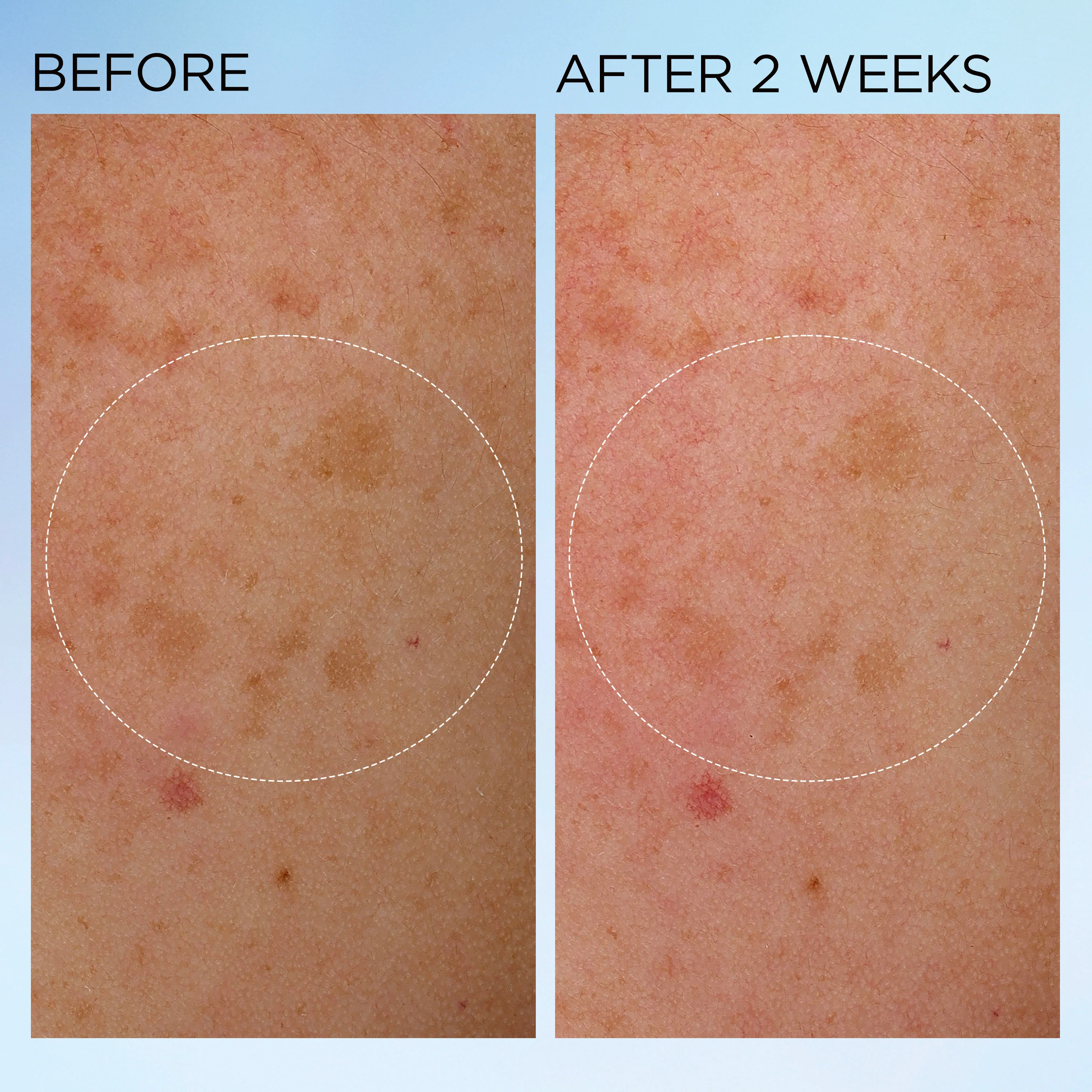 Visible Brightening Clearly Radiant Bounce Cream - Image 8